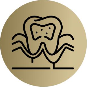 Veneers