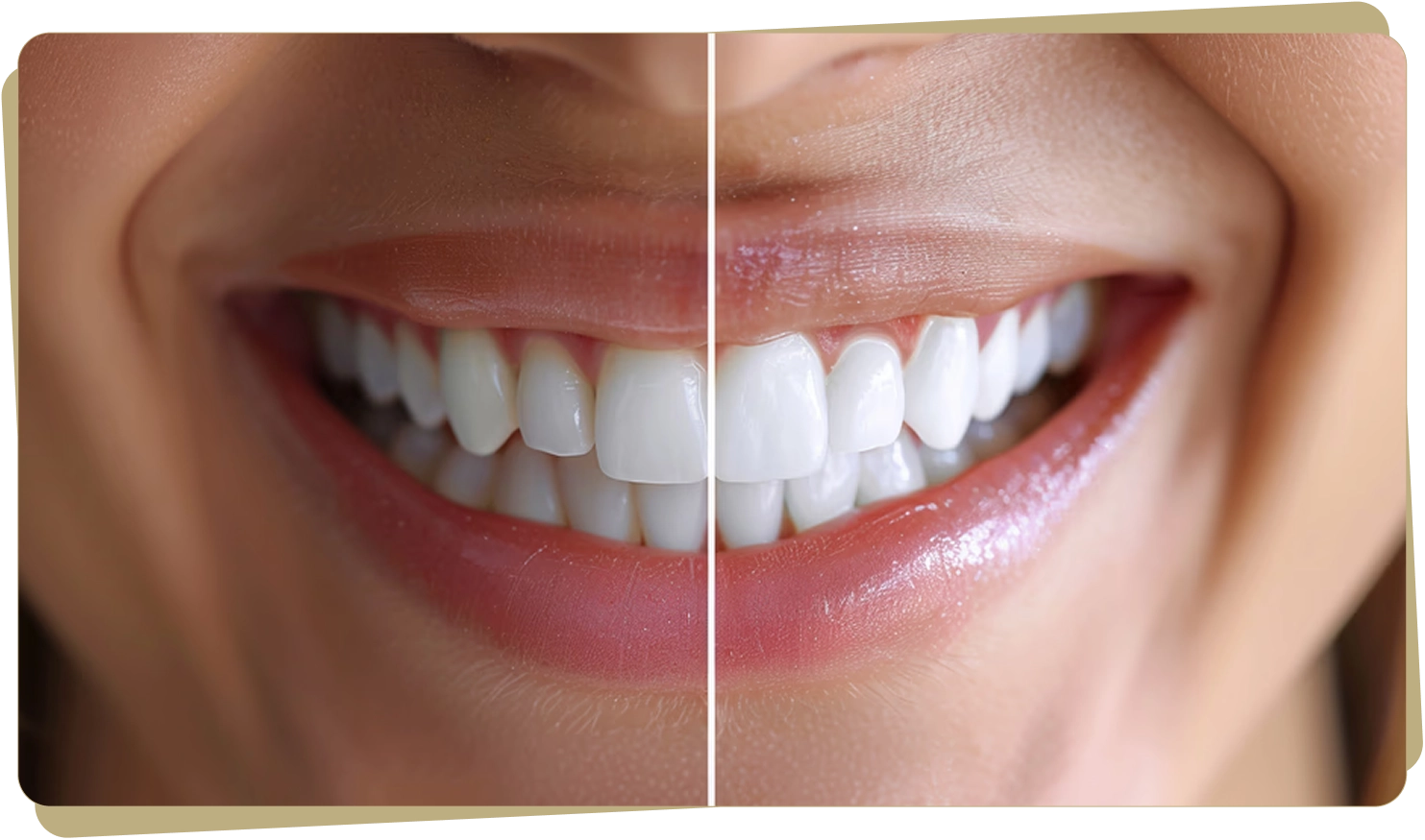 Cosmetic Dentistry At North <br>Vancouver Dentistry & Implant Centre