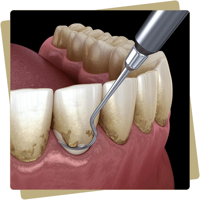 Periodontal Services