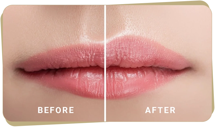 Lip Flip